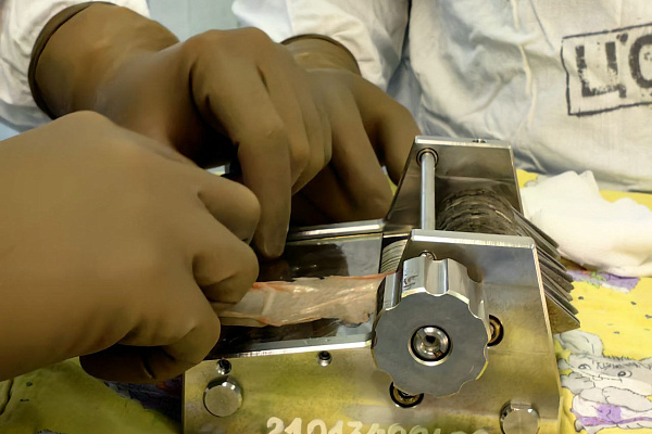 В Сургутской травмбольнице пациенту успешно провели этапное лечение тяжелой травмы нижней конечности после падения полуторатонной конструкции 