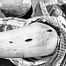 Два инсульта, и оба - с переломами. В Сургутской травматологической больнице повторно ставят на ноги 55-летнего мужчину 