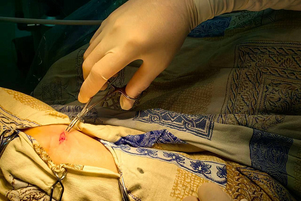 В Сургутской травмбольнице  начали выполнять уникальные для Югры малоинвазивные вмешательства при карпальном туннельном синдроме 